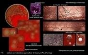 streptococcus pneumoniae